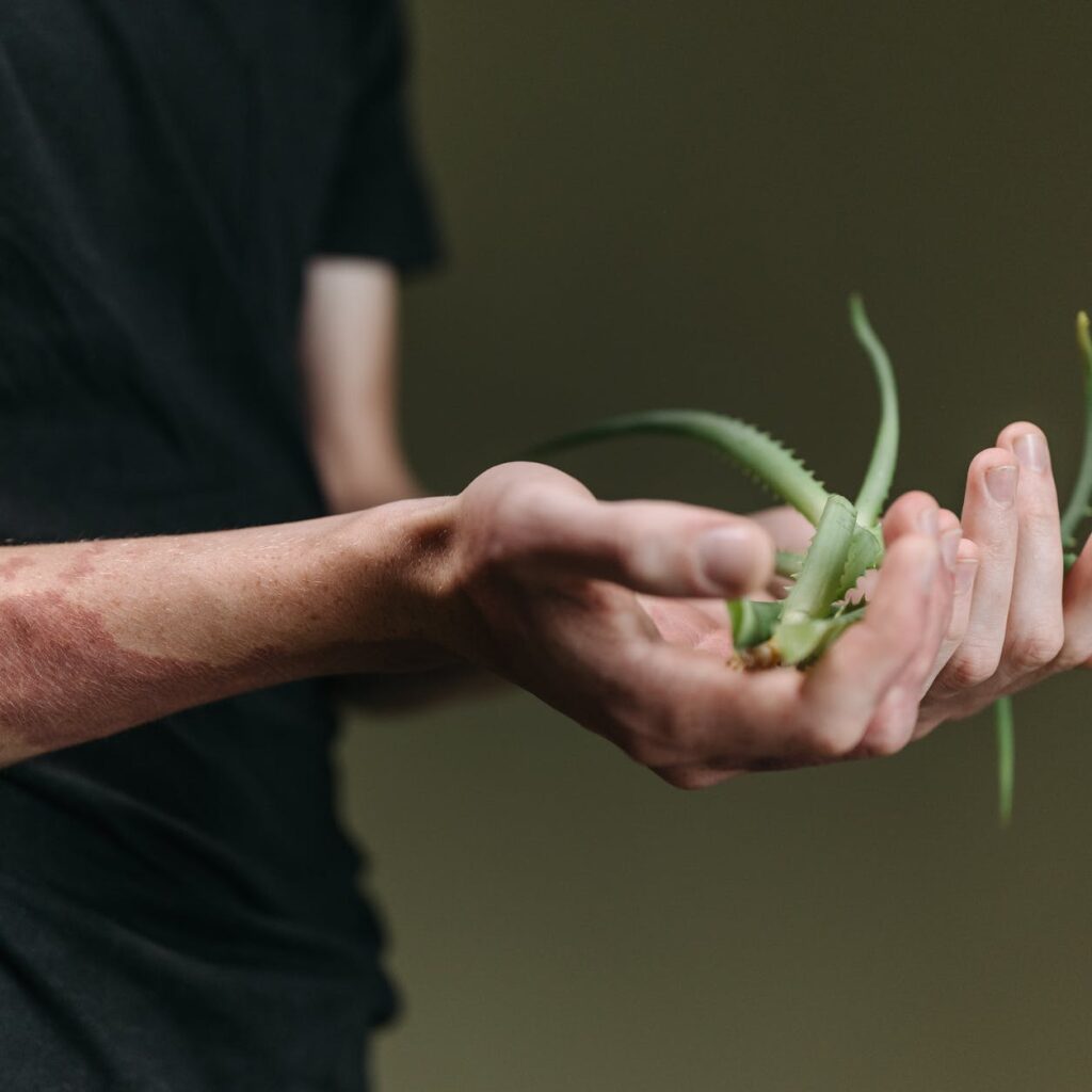 ¿Cómo eliminar cicatrices con aloe vera?