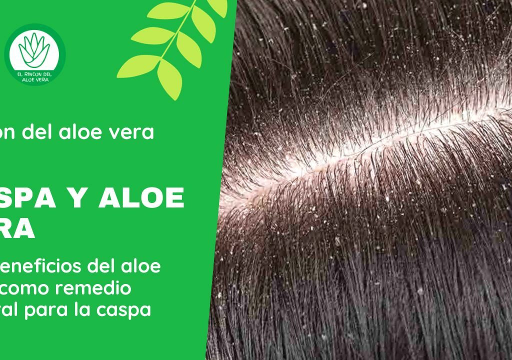 RINCON DEL ALOE VERA - Los beneficios del aloe vera como remedio natural para la caspa