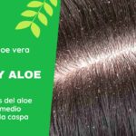 Combatir la caspa con Aloe: Los beneficios del aloe vera como remedio natural para eliminar la caspa con Aloe Vera casero RINCON DEL ALOE VERA - Los beneficios del aloe vera como remedio natural para la caspa
