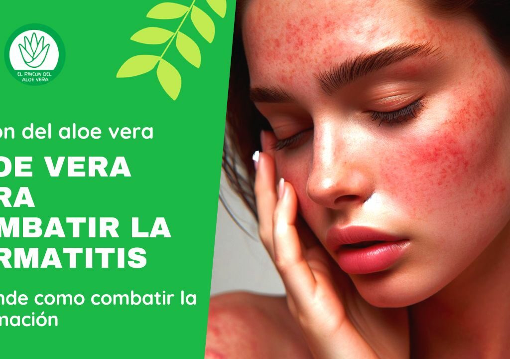 Aloe Vera Dermatitis: Cómo el Aloe Vera puede aliviar la dermatitis de forma natural