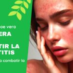 Aloe Vera Dermatitis: Cómo el Aloe Vera puede aliviar la dermatitis de forma natural